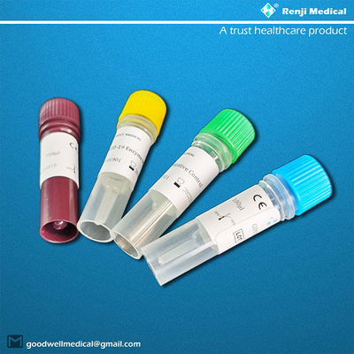 CER neue Coronavirus-Antigen-Test-Kit Complete-Ergebnisse 40-90 Minuten