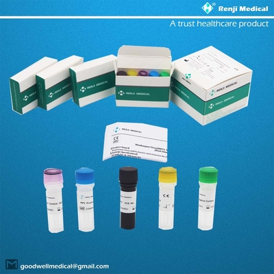 Monkeypox Virus (MPV) Nukleinsäure-Nachweis-Kit Fast Test Home Kit Real Time PCR Kit