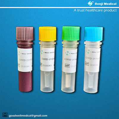 DNA-RNS Nukleinsäure Prüfungskit with real time fluorescent quantitativer PCR
