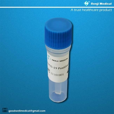 Ausgangstest Kit Oropharyngeal Nasopharyngeal 95% Empfindlichkeits-Sars-Cov-2