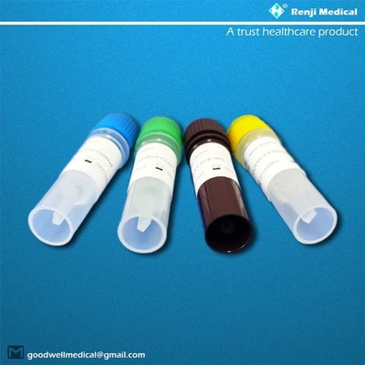 Realzeit-Funktelegrafie PCR Nukleinsäure Prüfungskit with sputum specimens